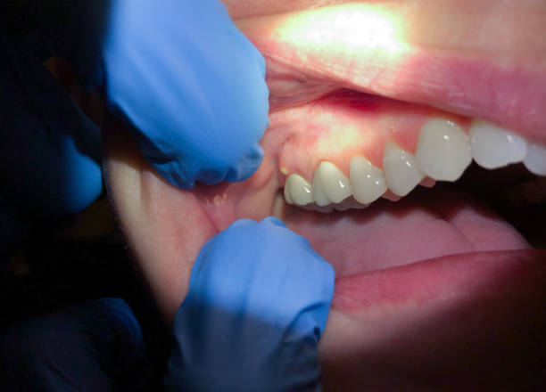 Best Emergency Dental Surgery in Roanoke, AL